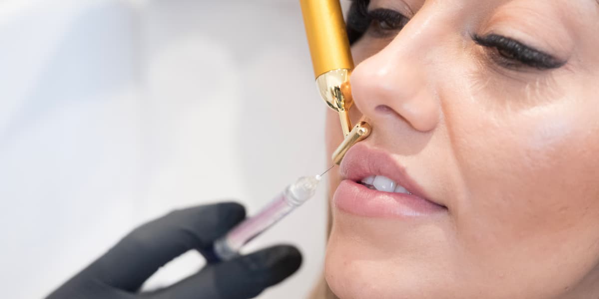 Lippen Aufspritzen Nürnberg: Die beliebtesten Techniken und Trends