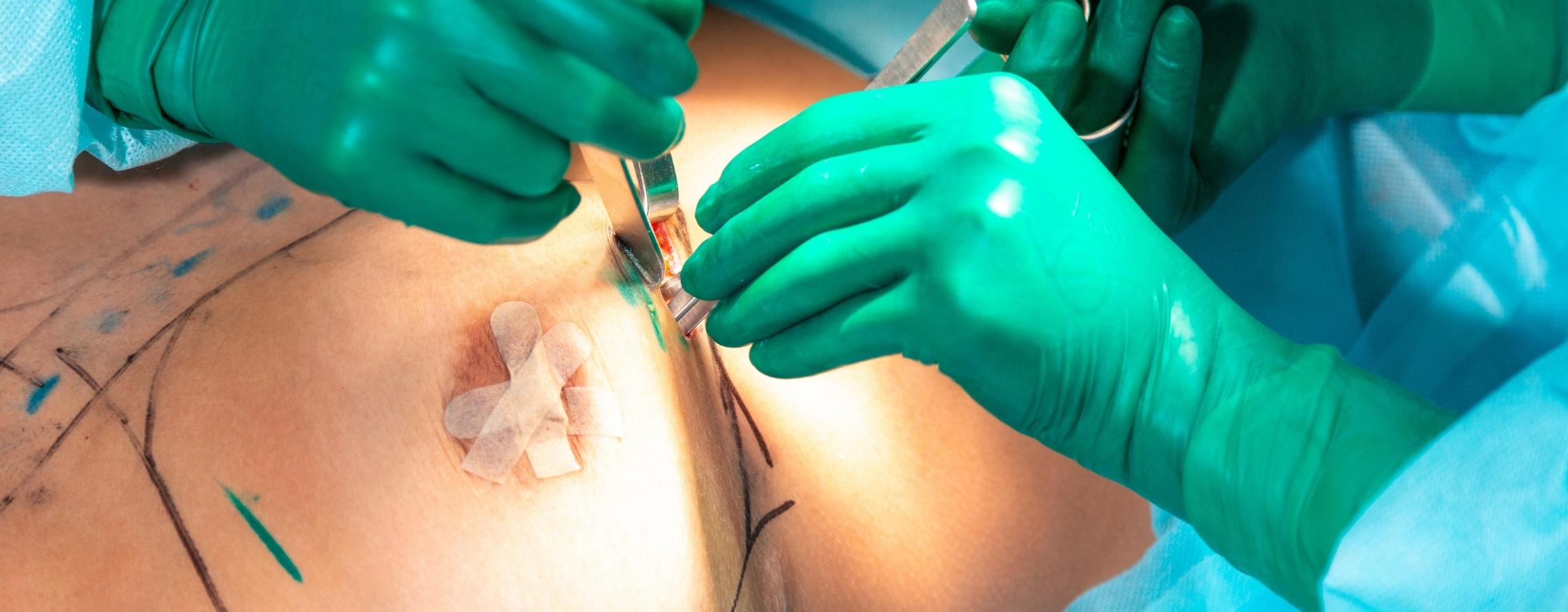 Selbstbewusstsein stärken: Brustchirurgie im Ästhetik Centrum Bochum