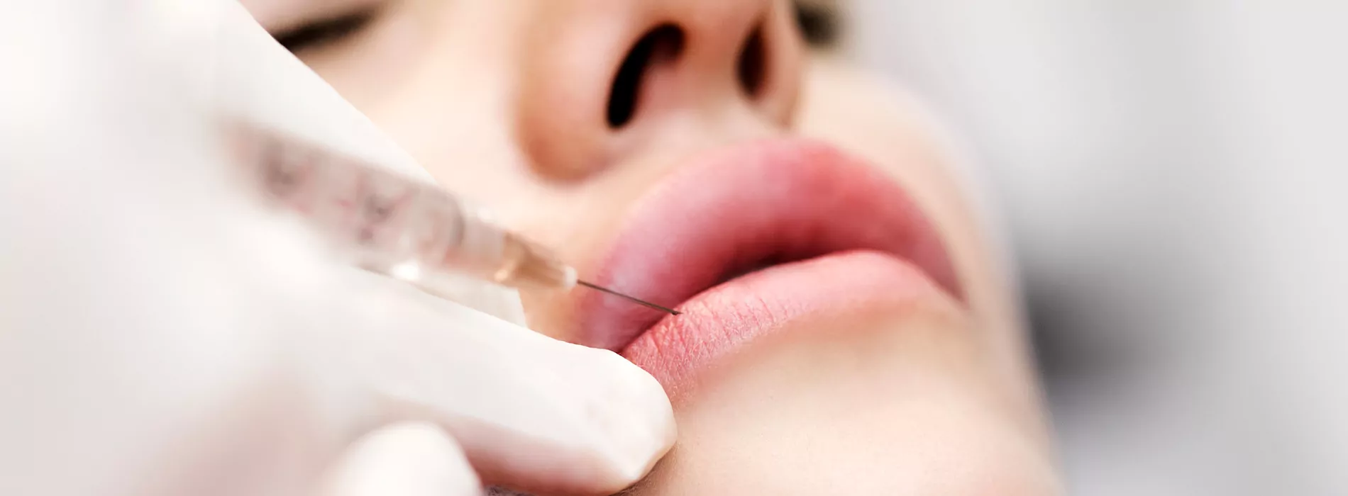 Verjüngen Sie Ihr Gesicht mit Lippen Aufspritzen Nürnberg und professionellen Behandlungen bei MY AESTHETICS