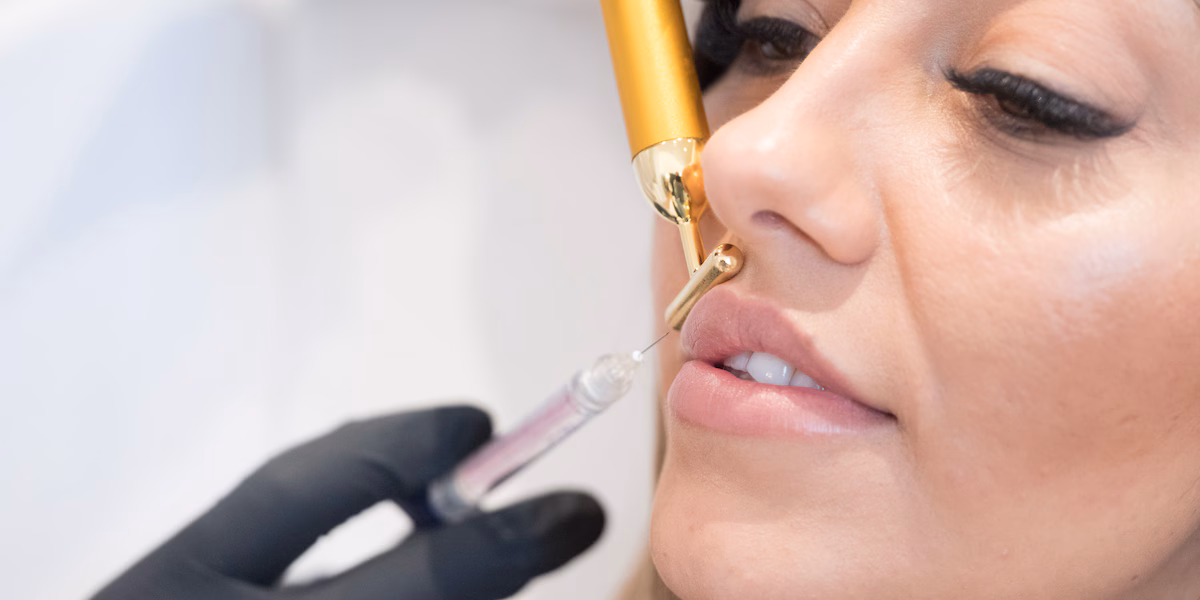 Lippen Aufspritzen Nürnberg: Die beliebtesten Techniken und Trends